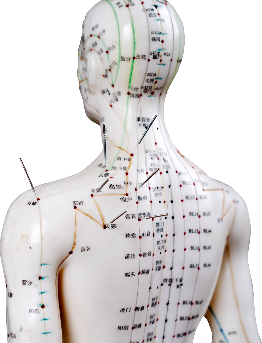 male-acupuncture-model-with-needles